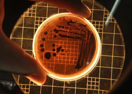 brock’s biology of microorganisms pdf