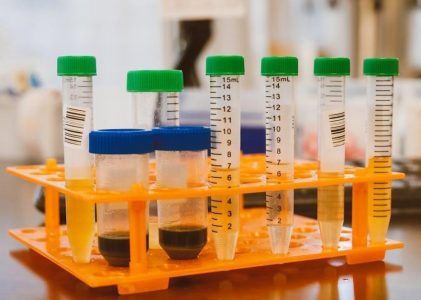 mosby’s manual of diagnostic and lab tests